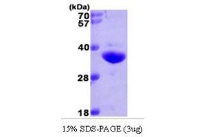 SDS-PAGE (SDS) image for NAD(P)H Dehydrogenase, Quinone 1 (NQO1) (AA 1-274) protein (His tag) (ABIN668043) (NQO1 Protein (AA 1-274) (His tag))