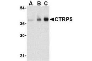 Western blot analysis of CTRP5 in human brain cell lysate with AP30254PU-N CTRP5 antibody at (A) 1, (B) 2, and (C) 4 μg/ml. (CTRP5 antibody  (N-Term))