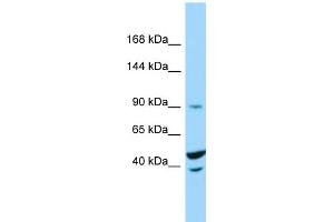 Host: Rabbit Target Name: TRIM71 Sample Type: THP-1 Whole Cell lysates Antibody Dilution: 1.