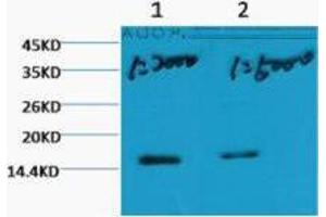 Western Blot (WB) analysis of HeLa, diluted at 1) 1:2000, 2) 1:5000.