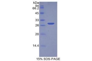 SDS-PAGE (SDS) image for Mercaptopyruvate Sulfurtransferase (MPST) (AA 68-278) protein (His tag) (ABIN2125851)