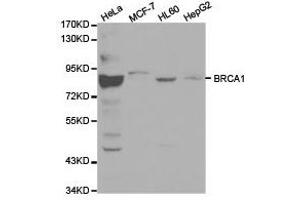 Western Blotting (WB) image for anti-Breast Cancer 1 (BRCA1) antibody (ABIN1871342) (BRCA1 antibody)