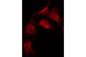 ABIN6267383 staining 293 by IF/ICC. (Ezrin antibody  (pThr567))
