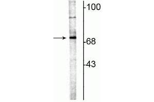 Western blot of rat hippocampal lysate showing specific immunolabeling of the ~70 kDa ChAT. (Choline Acetyltransferase antibody)