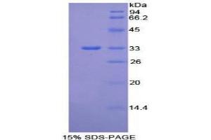 SDS-PAGE (SDS) image for Integrin beta 1 (ITGB1) (AA 454-714) protein (His tag) (ABIN2125332)