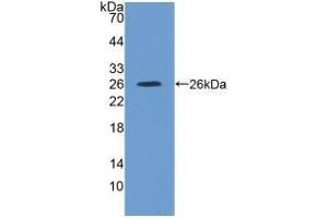 Detection of Recombinant IL4R, Rat using Polyclonal Antibody to Interleukin 4 Receptor (IL4R) (IL4 Receptor antibody  (AA 26-232))