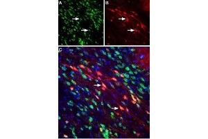 Expression of Neuropilin-2 in mouse substantia nigra pars compacta - Immunohistochemical staining of perfusion-fixed frozen mouse brain sections using Anti-Neuropilin-2 (NRP2) (extracellular) Antibody (ABIN7043380, ABIN7044700 and ABIN7044701), (1:400). (NRP2 antibody  (Extracellular, N-Term))