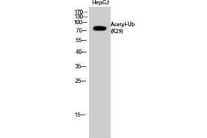 Western Blotting (WB) image for anti-Ubiquitin (Ubiquitin) (acLys29) antibody (ABIN3181497) (Ubiquitin antibody  (acLys29))