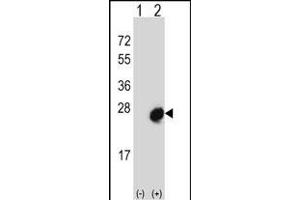Western blot analysis of MID1IP1 (arrow) using rabbit polyclonal MID1IP1 Antibody (N-term) (ABIN656689 and ABIN2845926).