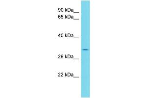 Host: Rabbit Target Name: MILR1 Sample Type: HepG2 Whole Cell lysates Antibody Dilution: 1. (Allergin-1 antibody  (C-Term))