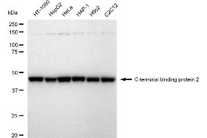 Western blotting analysis using C-terminal binding protein 2 antibody (ABIN7797816). (Recombinant CTBP2 antibody)