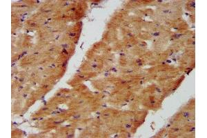IHC image of ABIN7160937 diluted at 1:400 and staining in paraffin-embedded human heart tissue performed on a Leica BondTM system. (NDUFB8 antibody  (AA 29-132))