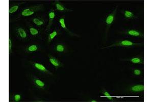 Immunofluorescence of purified MaxPab antibody to ZNF124 on HeLa cell. (ZNF124 antibody  (AA 1-289))