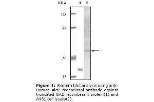 Image no. 1 for anti-V-Akt Murine Thymoma Viral Oncogene Homolog 2 (AKT2) antibody (ABIN232107) (AKT2 antibody)