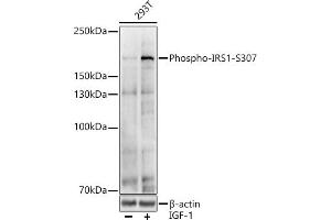 Western blot analysis of extracts of various cell lines, using Phospho-IRS1-S307 antibody (ABIN6135245, ABIN6136114, ABIN6136115 and ABIN6225577) at 1:1000 dilution.