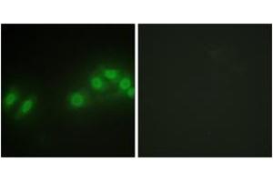 Immunofluorescence analysis of HepG2 cells, using LATS2 Antibody. (LATS2 antibody  (AA 541-590))