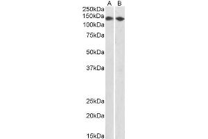 ABIN2561628 (0. (CCAR2 antibody  (AA 842-855))