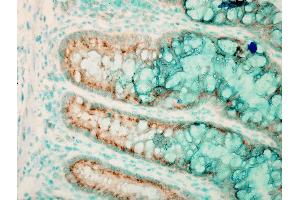 Immunohistochemistry (IHC) image for anti-Toll-Like Receptor 4 (TLR4) (AA 420-435) antibody (PE) (ABIN2485976)