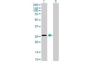 Western Blot analysis of UROS expression in transfected 293T cell line by UROS MaxPab polyclonal antibody. (UROS antibody  (AA 1-265))