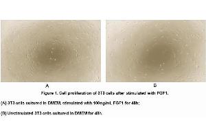 Image no. 3 for Fibroblast Growth Factor 1 (Acidic) (FGF1) (AA 16-155) (Active) protein (His tag) (ABIN6239853)