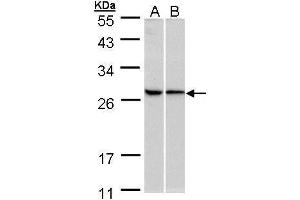 WB Image Sample (30 ug of whole cell lysate) A:293T B:HeLa 10% SDS PAGE antibody diluted at 1:500 (RPL13A antibody)