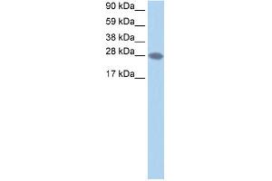 WB Suggested Anti-TCEA2 Antibody Titration:  1. (TCEA2 antibody  (N-Term))