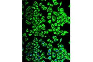 Immunofluorescence analysis of HeLa cells using SDHA Polyclonal Antibody (SDHA antibody)