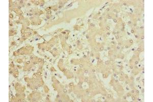 Immunohistochemistry of paraffin-embedded human liver tissue using ABIN7165639 at dilution of 1:100 (HOOK2 antibody  (AA 440-719))