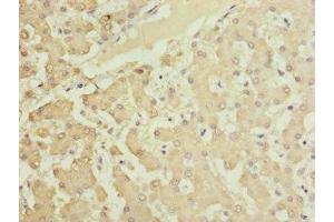 Immunohistochemistry of paraffin-embedded human liver tissue using ABIN7165639 at dilution of 1:100 (HOOK2 antibody  (AA 440-719))