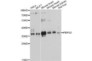 Western blot analysis of extracts of various cell lines, using PRPS2 antibody. (PRPS2 antibody)