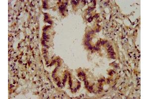 IHC image of ABIN7149098 diluted at 1:200 and staining in paraffin-embedded human lung tissue performed on a Leica BondTM system. (CYBA antibody  (AA 128-195))