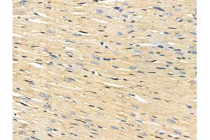 ABIN7093197 and ABIN7097208 at 1/100 staining Rat heart tissue by IHC-P. (ACSS1 antibody)