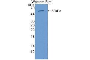 Western Blotting (WB) image for anti-Glucosidase, Beta, Acid (GBA) (AA 255-509) antibody (ABIN3205108) (GBA antibody  (AA 255-509))