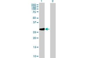 Western Blot analysis of RPA4 expression in transfected 293T cell line by RPA4 MaxPab polyclonal antibody. (RPA4 antibody  (AA 1-261))
