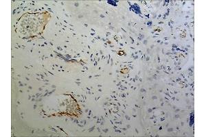 Immunohistochemistry (IHC) image for anti-Basal Cell Adhesion Molecule (Lutheran Blood Group) (BCAM) (AA 32-547) antibody (ABIN1983020) (BCAM antibody  (AA 32-547))