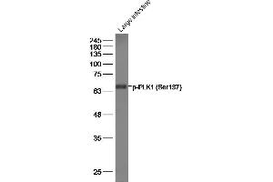 Mouse large intestine lysates, probed with PLK1 (Ser137) Polyclonal Antibody, unconjugated at 1:500 overnight at 4°C followed by a conjugated secondary antibody for 60 minutes at 37°C. (PLK1 antibody  (pSer137))