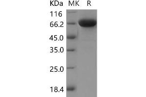 Western Blotting (WB) image for Immunoglobulin Superfamily, Member 8 (IGSF8) protein (His tag) (ABIN7320064) (IGSF8 Protein (His tag))