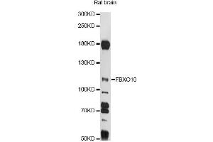 Western blot analysis of extracts of rat brain, using FBXO10 antibody (ABIN6292076) at 1:1000 dilution. (FBXO10 antibody)
