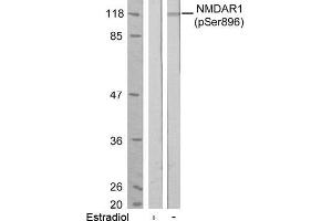 Image no. 1 for anti-NMDA Receptor 1 (NMDA R1) (pSer896) antibody (ABIN196795) (NMDA 1 Receptor antibody  (pSer896))