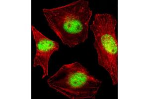 Fluorescent confocal image of Hela cell stained with SUMO2/3 Antibody (C-term E69) (ABIN1882138 and ABIN2845503). (SUMO2/3 antibody  (C-Term))