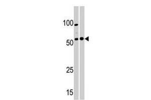 Western blot analysis of PKMYT1 polyclonal antibody  in A-375 (left) and Y-79 (right) cell line lysate.