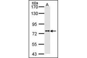 Sample (30 ug of whole cell lysate). (DPP8 antibody)