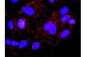 Proximity Ligation Analysis of protein-protein interactions between AKT1 and CDKN1A. (AKT1 antibody  (AA 1-480))
