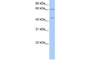 WB Suggested Anti-ZPLD1 Antibody Titration: 0. (ZPLD1 antibody  (C-Term))