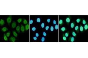 Immunocytochemistry staining of HeLa cells fixed in 1 % Paraformaldehyde and using R mouse mAb (dilution 1:100). (RPA1 antibody)