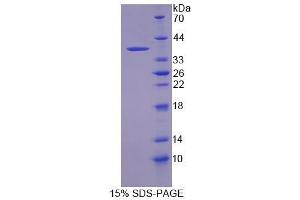 Image no. 1 for Contactin Associated Protein-Like 5 (CNTNAP5) (AA 25-302) protein (ABIN4990100) (CNTNAP5 Protein (AA 25-302))