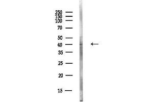 Western blot analysis of lysates from EC304 cells(heat-shock,45 min treatment), using LMAN2 Antibody at 1/1000 dilution.