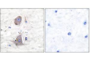 Immunohistochemistry (IHC) image for anti-Solute Carrier Family 2 (Facilitated Glucose Transporter), Member 1 (SLC2A1) (C-Term) antibody (ABIN1848583) (GLUT1 antibody  (C-Term))