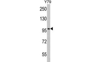 Western Blotting (WB) image for anti-Karyopherin (Importin) beta 1 (KPNB1) antibody (ABIN3002817) (KPNB1 antibody)