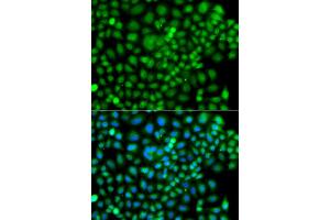 Immunofluorescence analysis of A549 cells using SUMO4 antibody (ABIN5975591). (SUMO4 antibody)